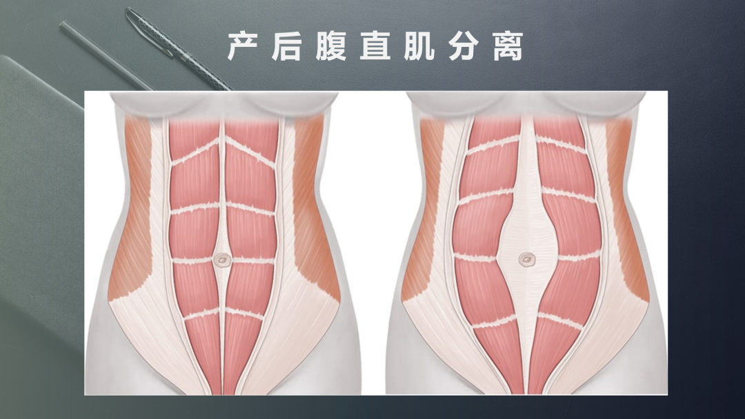 产后恢复加盟 产后恢复加盟